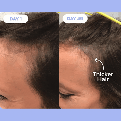 GlowBoost Hair Massager™